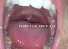 Chris Mouth Part6 Video1 Preview